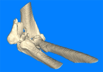 Virtual Surgery Sample