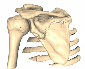 Virtual Surgery Sample