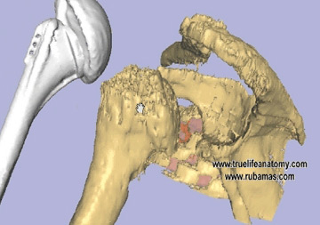 Virtual Surgery Sample